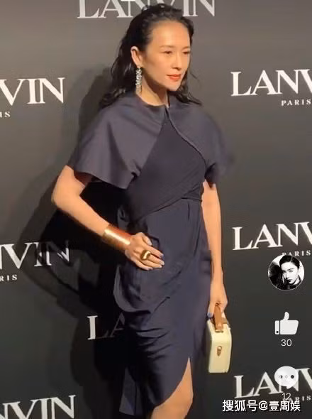 Nhan sắc Chương Tử Di xuống cấp thê thảm, lộ da chảy xệ, hói đầu sau sinh - ảnh 2