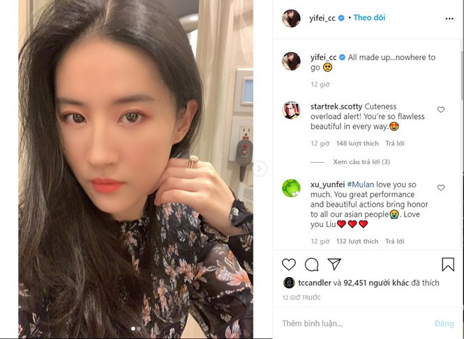 Nhan sắc Chương Tử Di xuống cấp thê thảm, lộ da chảy xệ, hói đầu sau sinh - ảnh 12