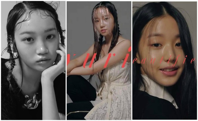 Nhan sắc Chương Tử Di xuống cấp thê thảm, lộ da chảy xệ, hói đầu sau sinh - ảnh 5