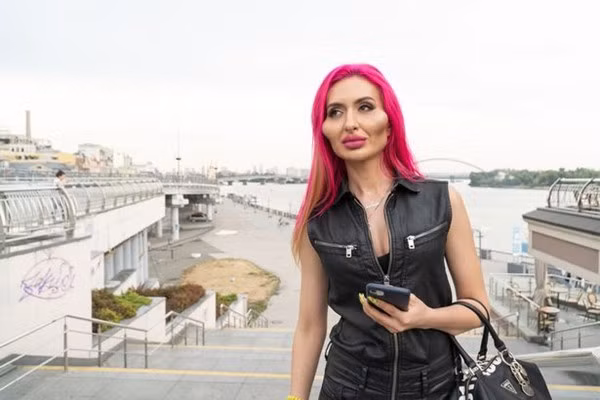 Người ta bơm vòng nọ vòng kia, riêng cô này chỉ bơm má để có “hai gò má to nhất thế giới” - ảnh 1