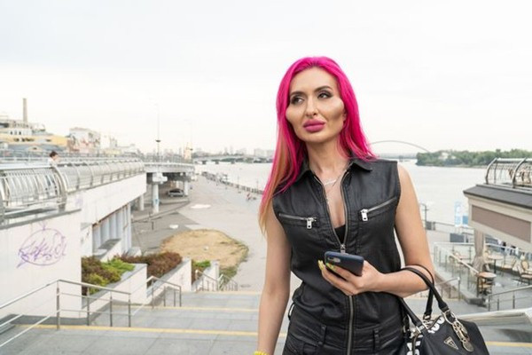 Người ta bơm vòng nọ vòng kia, riêng cô này chỉ bơm má để có “hai gò má to nhất thế giới” - ảnh 1