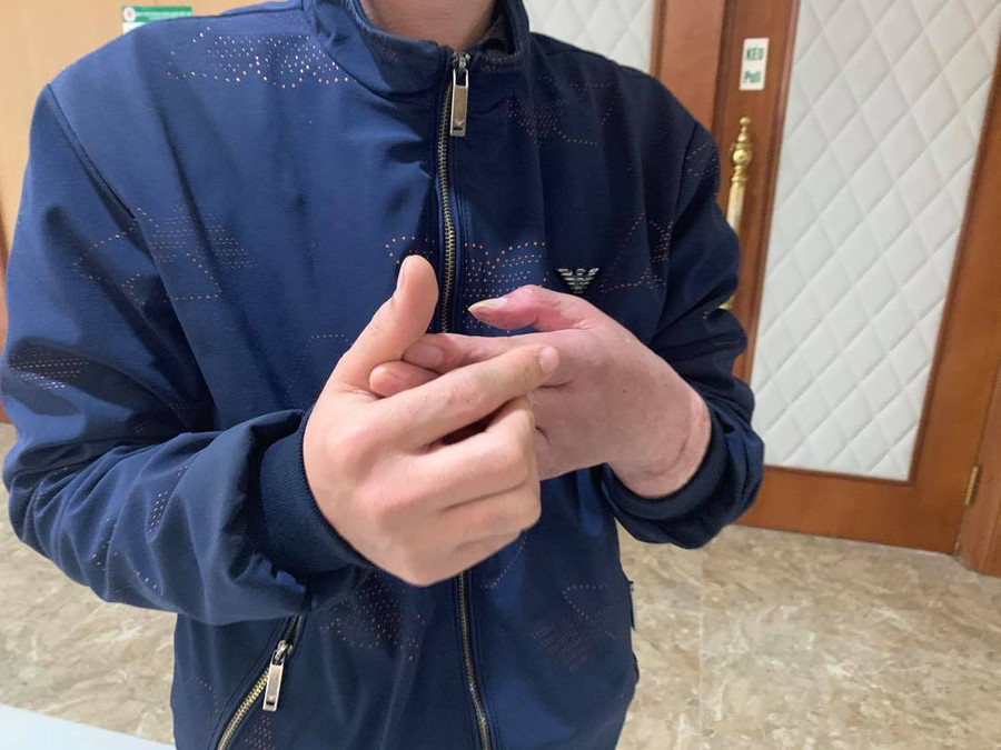 Bàn tay mới đã giúp anh hỗ trợ được gia đình trong cuộc sống. Cuộc sống mới của người đàn ông Việt Nam đầu tiên được ghép tay -0