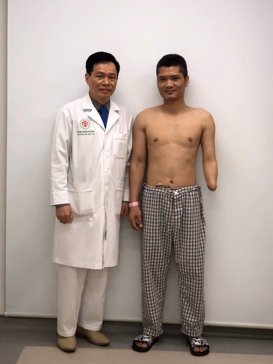 GS, TS Nguyễn Thế Hoàng cùng Phạm Văn Vương trước ghi ghép. Cuộc sống mới của người đàn ông Việt Nam đầu tiên được ghép tay -0