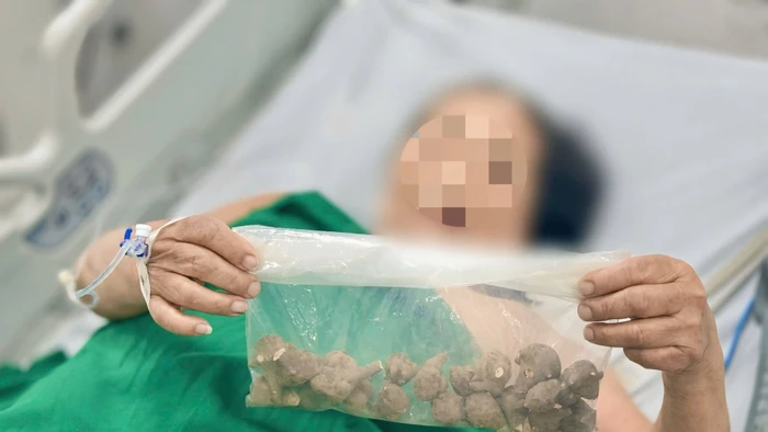 Củ ấu tầu được bệnh nhân mua qua mạng. Ảnh: BVCC