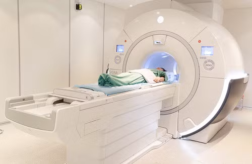 Đột quỵ não và vai trò của chụp cộng hưởng từ (MRI) trong tầm soát đột quỵ - ảnh 5