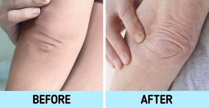 7 bộ phận cơ thể "tố cáo" tuổi thật bạn không thể giấu ảnh 1