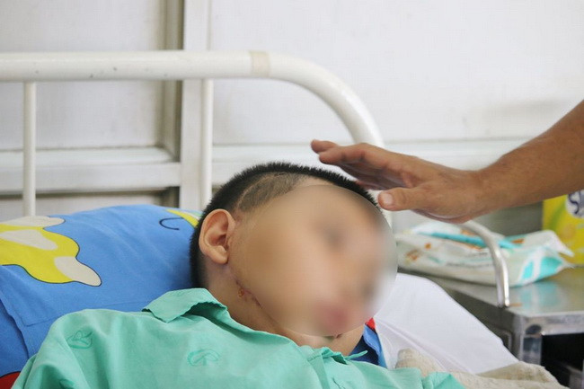 Bệnh nhi đã được phẫu thuật lấy khối u ra khởi cơ thể (Ảnh: BVCC). Bệnh nhi đã được phẫu thuật lấy khối u ra khởi cơ thể (Ảnh: BVCC).