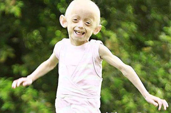 Kỳ dị: Cô bé lông sói, người phụ nữ có 3 bầu ngực