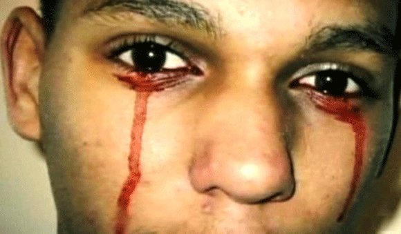 Kỳ dị: Cô bé lông sói, người phụ nữ có 3 bầu ngực