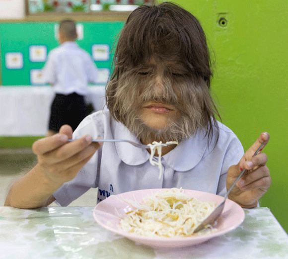 Kỳ dị: Cô bé lông sói, người phụ nữ có 3 bầu ngực