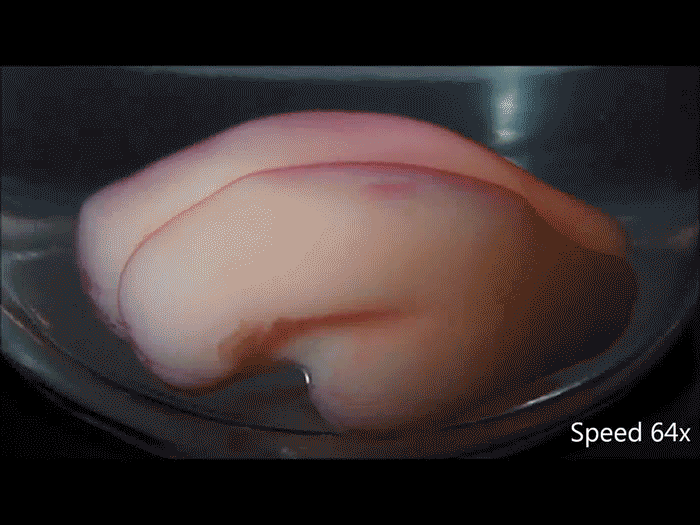 Phát hiện cách các nếp nhăn hình thành nhờ não in 3D