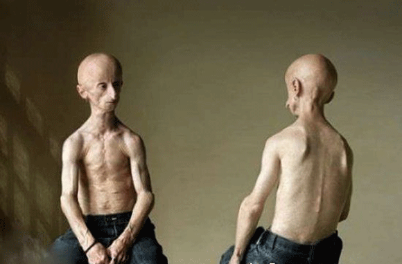 Kỳ dị: Cô bé lông sói, người phụ nữ có 3 bầu ngực