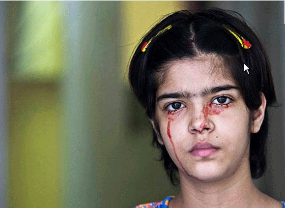 Kỳ dị: Cô bé lông sói, người phụ nữ có 3 bầu ngực