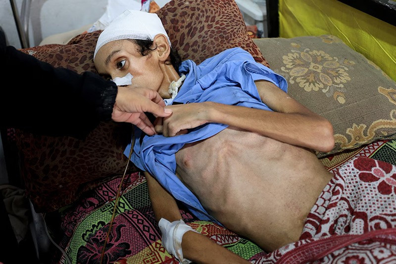 chum-anh-nan-doi-ngay-cang-nghiem-trong-o-dai-gaza-0705-02.jpg