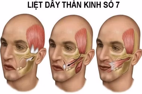 Minh họa/INT