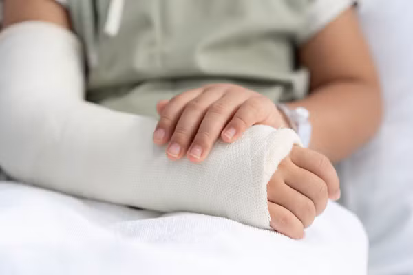 Tai nạn khi vui chơi là một trong những nguyên nhân phổ biến gây gãy xương ở trẻ em. Ảnh minh họa: INT.