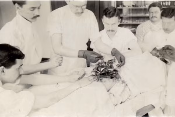 Một bác sĩ đeo găng tay cao su trong ca mổ vào năm 1893. 