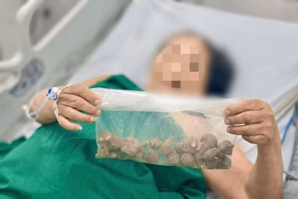 Củ ấu tầu được bệnh nhân mua qua mạng. Ảnh: BVCC