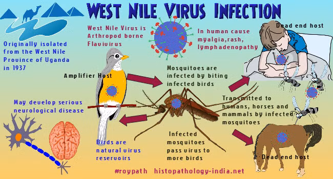 Virus gây sốt Tây sông Nile có thể gây viêm màng não và khiến 32 người Israel thiệt mạng trong vòng 7 tháng đầu năm 2024.