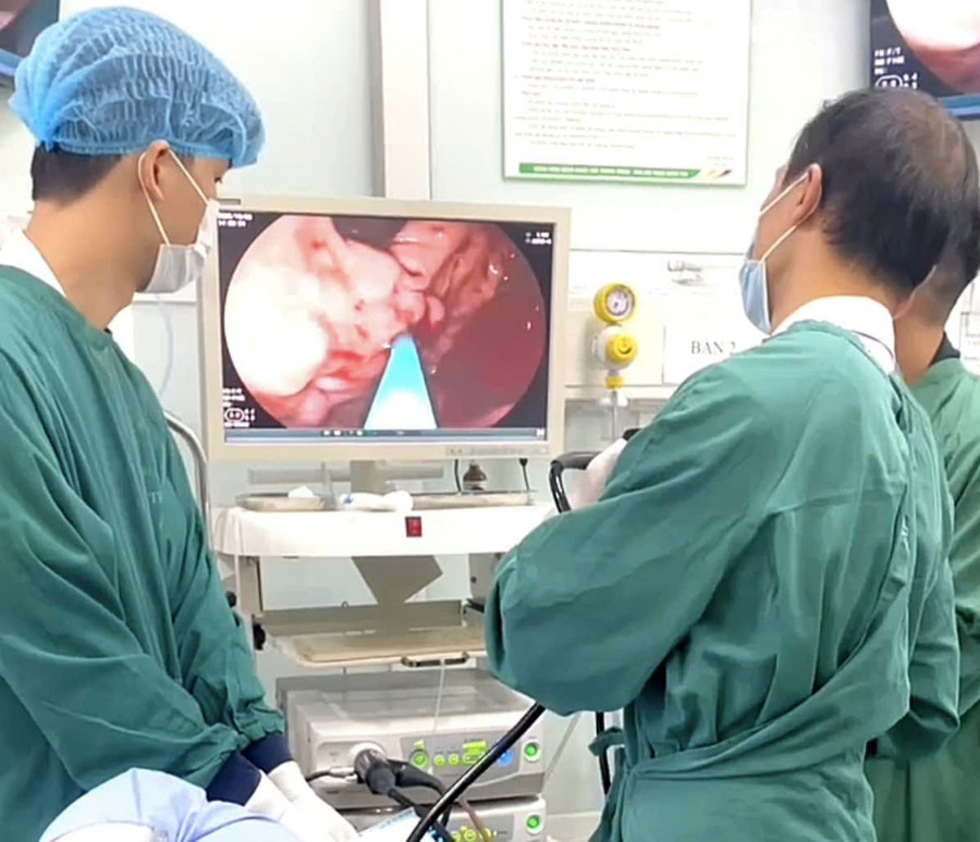 Bệnh nhân được chỉ định nội soi tiêu hóa thăm dò chức năng để tìm điểm xuất huyết. Ảnh: BVCC