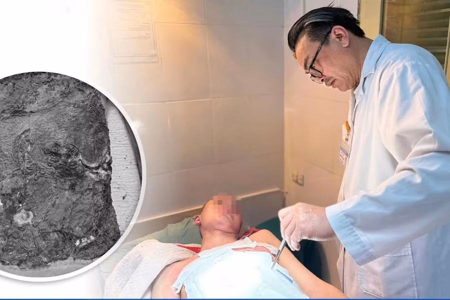 Bác sĩ Thái Văn Bình điều trị cho bệnh nhi. Ảnh: BVCC