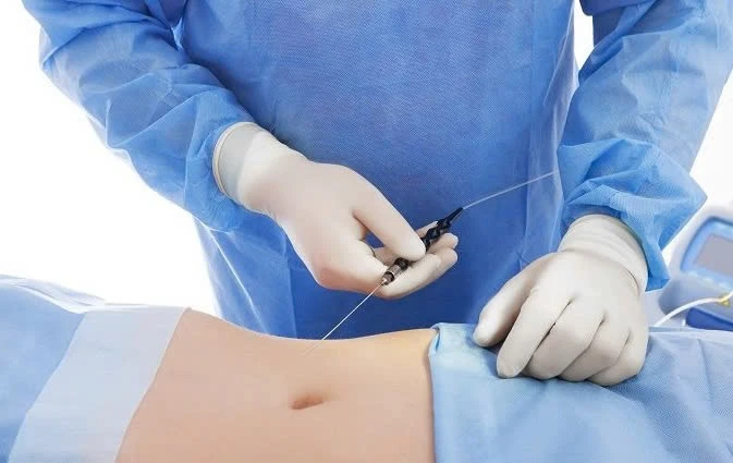 Đừng vì vẻ đẹp bên ngoài mà đánh cược mạng sống bằng tờ giấy cam kết khi bản thân có bệnh nền. Ảnh minh họa: INT