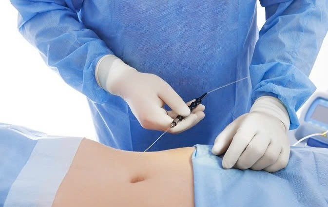 Đừng vì vẻ đẹp bên ngoài mà đánh cược mạng sống bằng tờ giấy cam kết khi bản thân có bệnh nền. Ảnh minh họa: INT