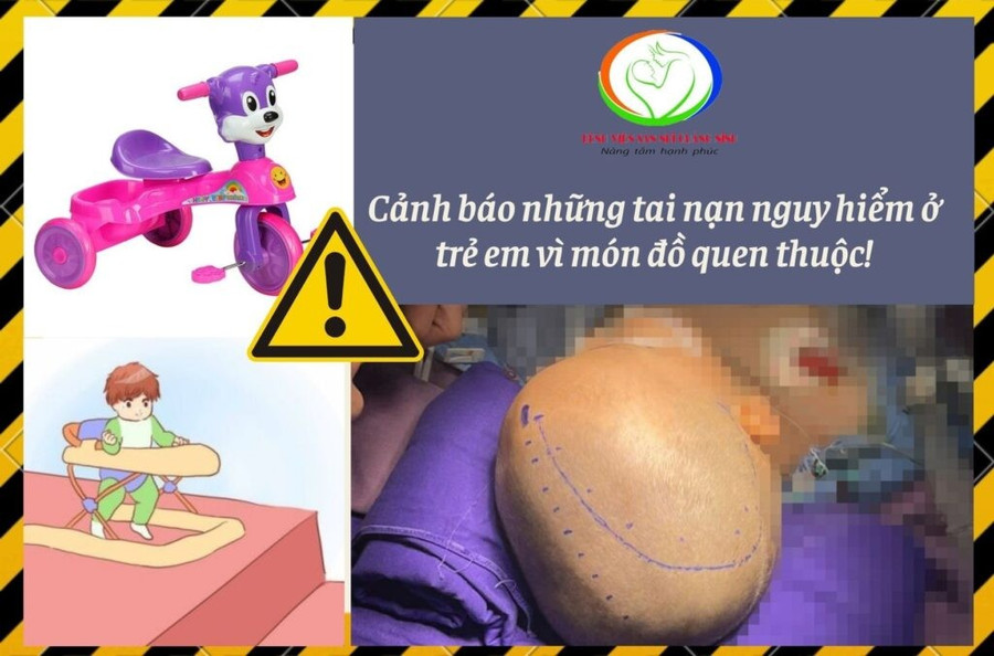 Bác sĩ cảnh báo, xe tập đi, xe 3 bánh không có dây bảo hiểm có thể gây nguy hiểm cho trẻ. Ảnh: BV