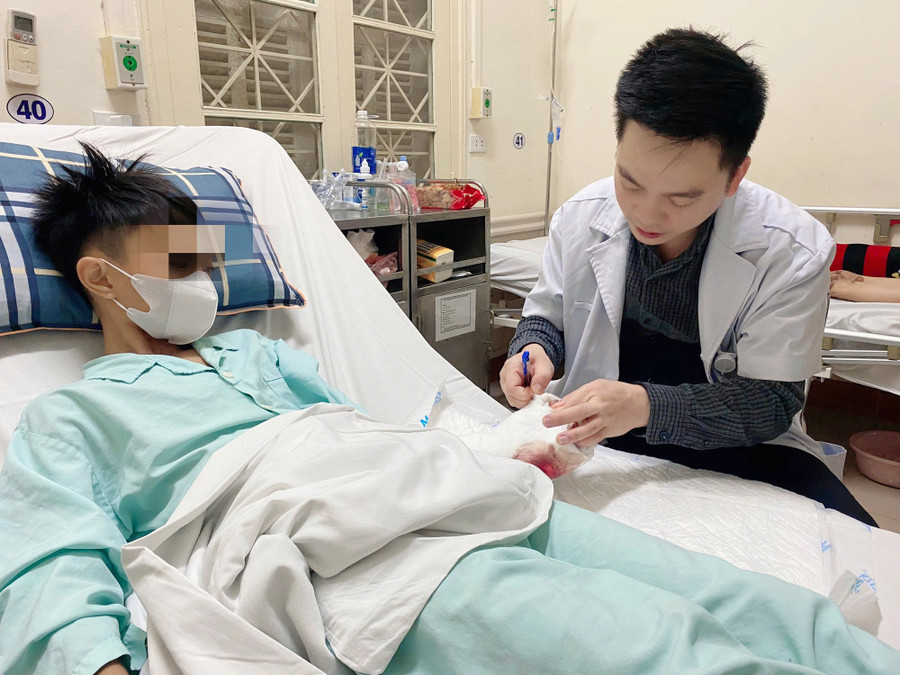 Trường hợp bị thương do pháo nổ tự chế điều trị tại Bệnh viện Hữu nghị Việt Đức. Ảnh: BVCC