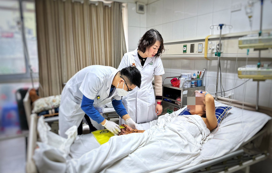 Bệnh nhân gặp nạn do pháo tự chế phát nổ được điều trị tại Bệnh viện Hữu nghị Việt Đức. Ảnh: BVCC
