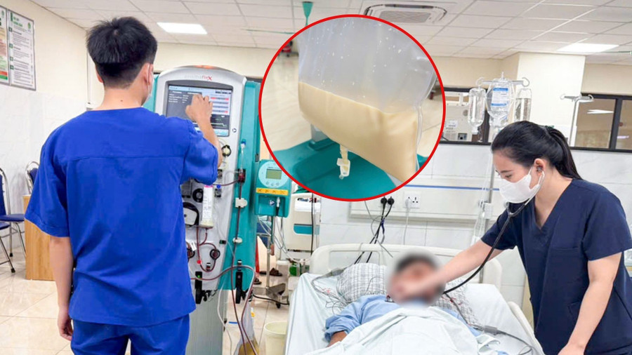 Bệnh nhân bị viêm tụy cấp do tăng Triglycerid (tăng mỡ máu). Ảnh: INT