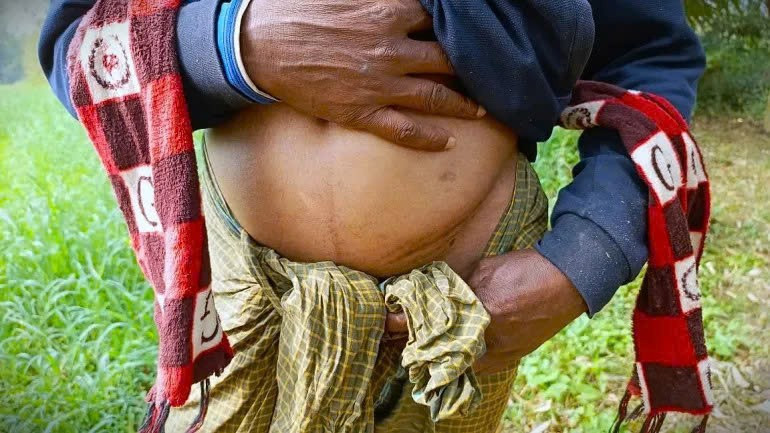 Những người hiến tạng không được chăm sóc sau phẫu thuật. ben-trong-ngoi-lang-mot-qua-than-2.jpg