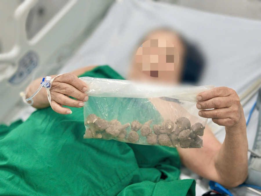 Củ ấu tầu được bệnh nhân mua qua mạng. Ảnh: BVCC