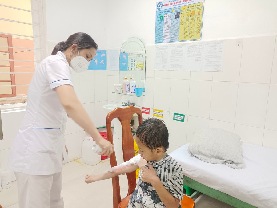 Bác sĩ xử trí cho bệnh nhi bị bỏng. Ảnh: Bệnh viện Đa khoa tỉnh Cao Bằng tre-bi-bong-can-thuc-hien-nhung-buoc-so-cuu-nao.jpg