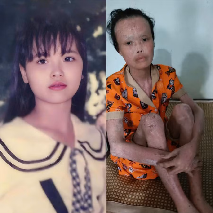 Đẫm nước mắt trước tình cảnh của cô giáo bạc mệnh 