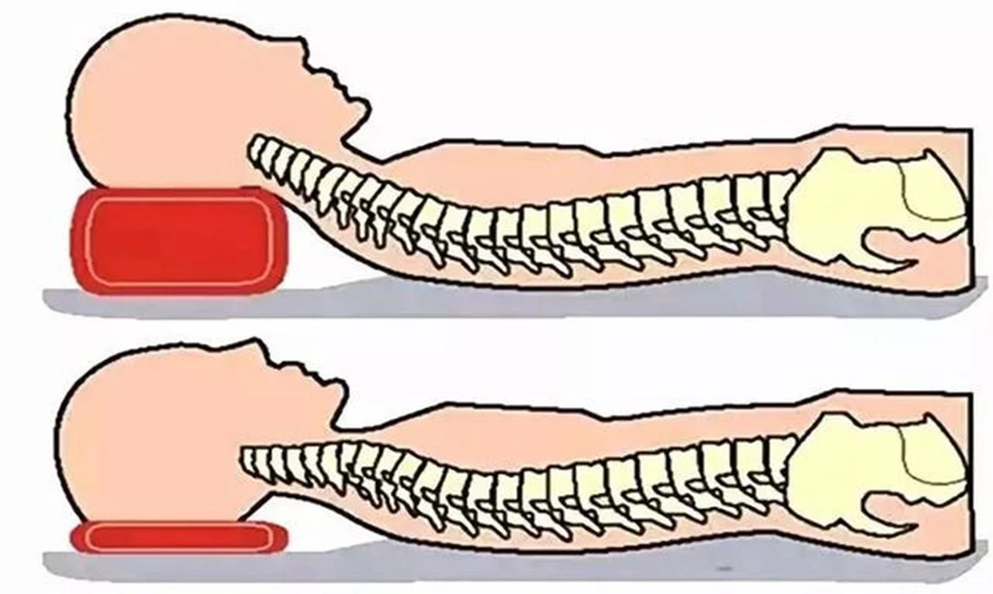 Sử dụng gối không đúng cách có thể gây ra nhiều tác hại cho cơ thể. (Ảnh: ITN)