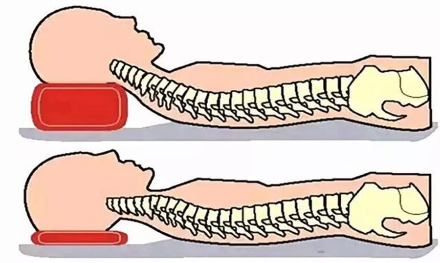 Sử dụng gối không đúng cách có thể gây ra nhiều tác hại cho cơ thể. (Ảnh: ITN)