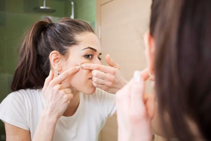 Ăn nhiều đường gây ra mụn trứng cá và viêm nhiễm. (Ảnh: ITN)