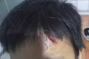 Cháu T bị đánh bị thương ở vùng đầu.