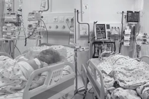 Đội ngũ y bác sĩ đang nỗ lực bằng các phương pháp để giành sự sống cho hai bệnh nhi.