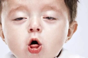 Bệnh ho gà thường xảy ra ở trẻ dưới 5 tuổi. (Ảnh minh họa: ITN).