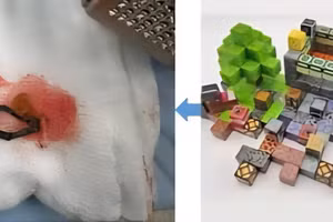 Trẻ cắn nắp nhựa từ các khối vuông nhỏ xếp Lego và nuốt viên nam châm bên trong. 