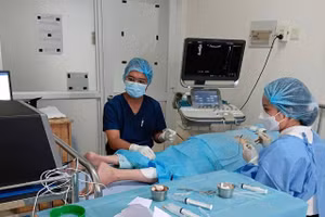 Bác sĩ đưa một điện cực rất nhỏ vào chính xác vị trí nhánh thần kinh chi phối cảm giác đau ở vùng thắt lưng của bệnh nhân.