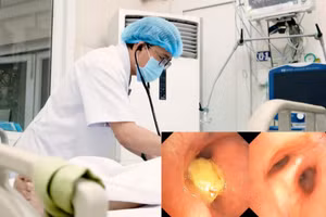 Trẻ nhỏ và người lớn tuổi có nguy cơ hóc dị vật cao. 