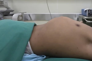 Bệnh nhân trước khi thực hiện phẫu thuật. 