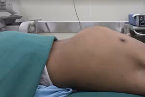 Bệnh nhân trước khi thực hiện phẫu thuật. 