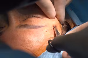 Hơn 300 cơ sở thẩm mỹ trên địa bàn Quận 10 sẽ bị kiểm tra đột xuất trong vòng 45 ngày.