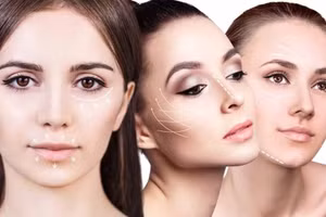 Các cơ sở thẩm mỹ tại TPHCM bị xử phạt. (Ảnh minh họa)