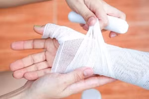 Bỏng xăng rất nguy hiểm do nhiệt độ cao và khả năng gây bỏng sâu. (Ảnh minh họa: ITN)