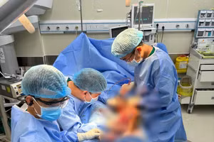 Ê kíp thực hiện phẫu thuật.